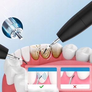 Skaler Ultradźwiękowy do Zębów Usuwania Kamienia Nazębnego Dentystyczny LED 4