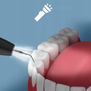 Skaler Ultradźwiękowy do Zębów Usuwania Kamienia Nazębnego Dentystyczny LED 6