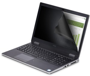StarTech.com 14-inch 16:10 Laptop Touch Privacy Screen, Flip-Up - Blickschutzfilter fur Notebook - 2-Wege - Klebestreifen, Schiebelaschen, Flexi-Scharniere - 35.6 cm (14") - durchsichtig 4