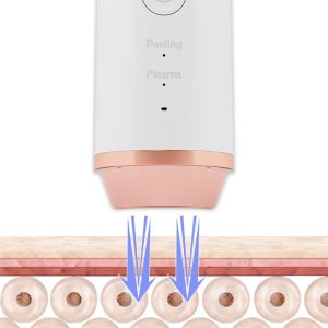 URZĄDZENIE DO REGENERACJI SKÓRY TWARZY Z PEELINGIEM B-PASMA PRO 6