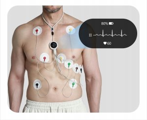 CheckMe LepodPro 12-kanałowe urządzenie EKG 24h zapis AI 4
