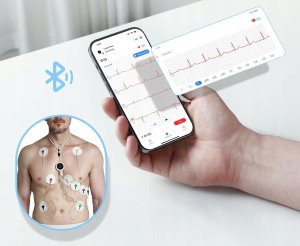 CheckMe LepodPro 12-kanałowe urządzenie EKG 24h zapis AI 5