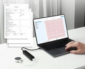 CheckMe LepodPro 12-kanałowe urządzenie EKG 24h zapis AI 6