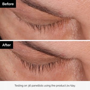 The Ordinary Multi-Peptide Lash & Brow Serum - - 5 ml 7