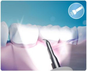 Berdsen Skaler ultradźwiękowy kamera do zębów 4 tryby do usuwania kamienia LED Berdsen BD-250 10