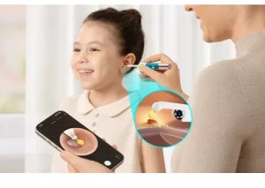Bebird Otoskop z kamerą BEBIRD Earsight Ultra 3