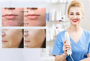 Darsonval Derma Wand 6 Elektrod Ozonoterapia Do Twarzy i Ciała 5