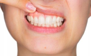 Vitis VITIS GINGIVAL ZESTAW PODRÓZNY 2
