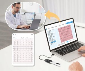 CheckMe ER1-LW Przenośny 24-godzinny monitor EKG metodą Holtera AI 3