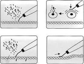 RoyalElite Peeling kawitacyjny bezprzewodowy Skin scrubber (8020) 5