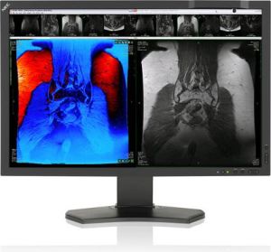 Monitor NEC MD242C2 24/FHD/IPS/14ms 4