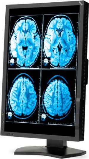 Monitor NEC MD242C2 24/FHD/IPS/14ms 5