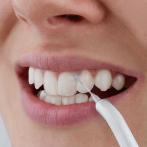 Irygator Sencor SOI 1102TQ 9