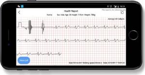 Smartwatch ProMedix PR-510 Czarny  (PR-510) 7