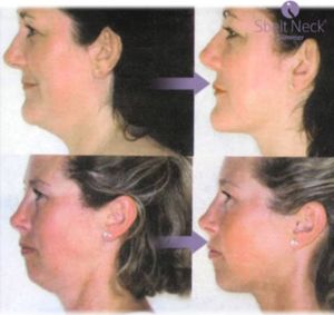 InnovaGoods Masażer podbródka policzków redukujący podwójny drugi podbródek 7