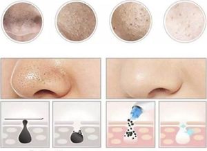 Asato Odkurzacz Do Wągrów Próżniowy Mikrodermabrazja Ds 6