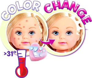 Simba Evi Love lalka chora na ospę ponownie zdrowa 4