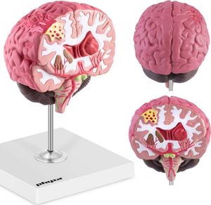 Physa Model anatomiczny 3D mózgu ludzkiego z 3 patologiami skala 1:1 1