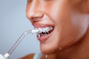 Irygator Krexus EX9161 4