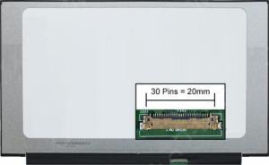 CoreParts 15,6" LCD FHD Glossy 1