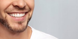 ApaCare APACARE PROFFESIONAL PASTA 20ML 4