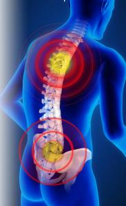 Fit4Med Korektor Wad Postawy Kręgosłupa Na Proste Plecy 9