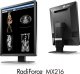 Monitor Eizo RadiForce MX216-HBBK 2