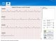 PM Podręczny Aparat EKG, zaburzenia rytmu serca, Arytmia, Software 4