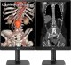 Monitor LG 21HQ513D-B Diagnostic Monitor 10