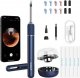 Bebird Otoskop z kamerą do czyszczenia uszu Bebird Note 5 pro (niebieski) 1