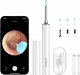 Bebird Otoskop z kamerą do czyszczenia uszu Bebird T15 (biały) 1
