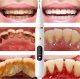 Irygator PrzydaSie Skaler Ultradźwiękowy Dentystyczny Do Zębów Do Usuwania Kamienia 10