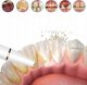 Irygator PrzydaSie Skaler Ultradźwiękowy Dentystyczny Do Zębów Do Usuwania Kamienia 8