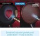 MediaShop Livington Copper & Stone Pan 28 cm 9