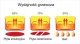Płyta grzewcza VOV PŁYTA INDUKCYJNA 2 POLA DO ZABUDOWY WOLNOSTOJĄCA 5