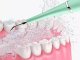 Verk Skaler dentystyczny ultradźwiękowy do czyszczenia zębów usuwanie kamienia Skaler dentystyczny ultradźwiękowy do czyszczenia zębów usuwanie kamienia 2