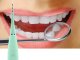 Verk Skaler dentystyczny ultradźwiękowy do czyszczenia zębów usuwanie kamienia Skaler dentystyczny ultradźwiękowy do czyszczenia zębów usuwanie kamienia 8