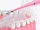Verk Skaler dentystyczny ultradźwiękowy do czyszczenia zębów usuwanie kamienia Skaler dentystyczny ultradźwiękowy do czyszczenia zębów usuwanie kamienia 2
