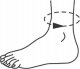 ORTHO VISIONS ORTEZA STAWU SKOKOWEGO STABILIZATOR KOSTKI I STOPY 6