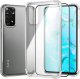 Hello Case Etui Xiaomi Redmi Note 11 / 11s (Przezroczyste,Pancerne Szkło Pełne 9H) 1
