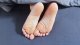 MDH Post operative shoe - Rozmiar M 2