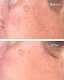 MURAD_Correct And Protect Serum serum do twarzy SPF45 30ml 2