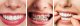 Irygator Oclean Oclean Oral Irrigator Oclean A10 Grey 7