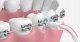 Irygator Oclean Oclean Oral Irrigator Oclean A10 Grey 9