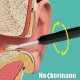 Heckermann Otoskop do czyszczenia uszu Heckermann NE6 Czarny 4