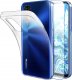 Etui Do Realme 7 Pro (Przezroczyste, Silikonowe, Ochronne, Case)   Szkło 9H 1