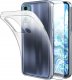 Etui Do Motorola Moto G60 (Przezroczyste, Silikonowe, Ochronne)   Szkło 9H 1