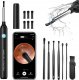 SMART OTOSKOP KAMERA CZYSZCZENIE USZU WOSK WIFI HD 1