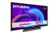 Telewizor Hyundai HD 24'' - HLA24451 Android 2