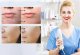 Darsonval Derma Wand 6 Elektrod Ozonoterapia Do Twarzy i Ciała 5